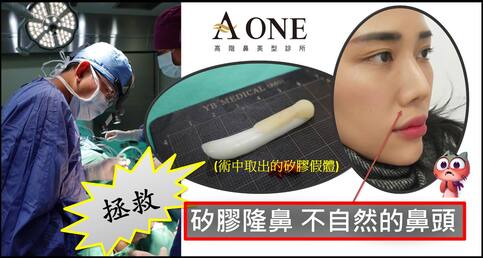 拯救「矽膠隆鼻」不自然的鼻頭