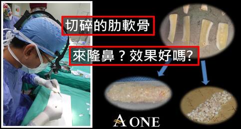 切碎的肋軟骨，拿來隆鼻好嗎？